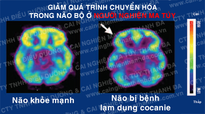 ma tuy