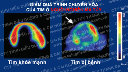 ma tuy