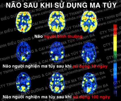 ma tuy
